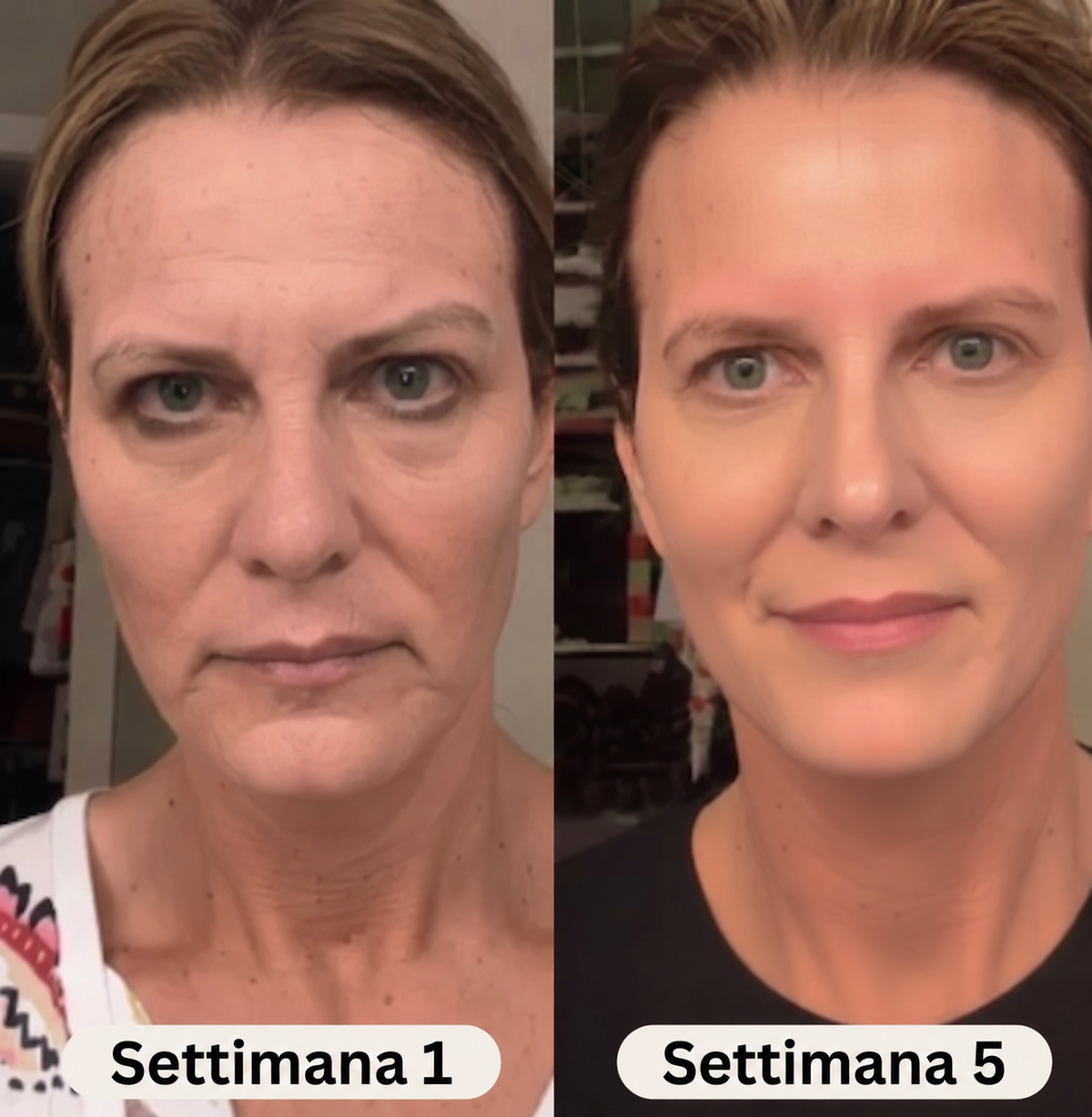 Siero al collagene coreano per pelli mature