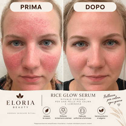 Rice Glow | Blocca il Rossore alla Fonte