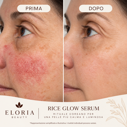 Rice Glow | Blocca il Rossore alla Fonte