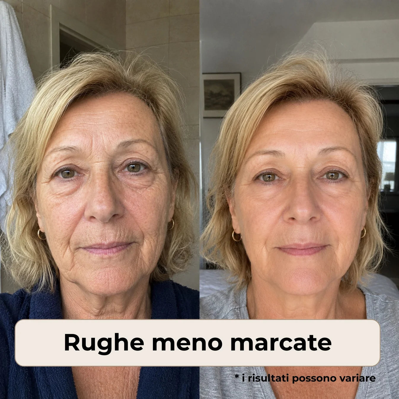 ELORIA™ Crema Anti-Età