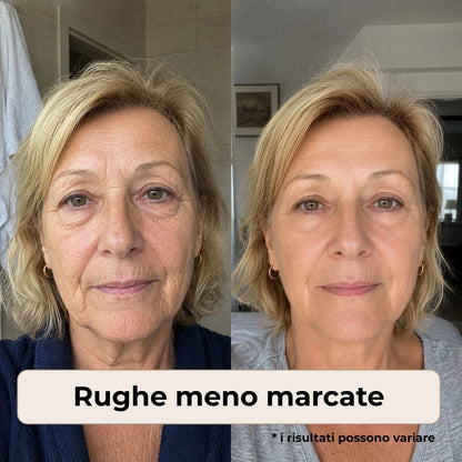 ELORIA™ Crema Anti-Età